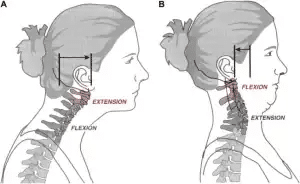 diagram of chin/neck stretches
