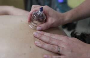 lymphatic cupping