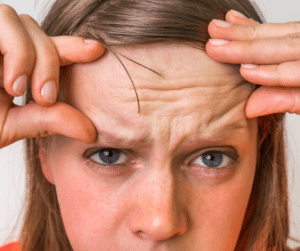 woman looking at wrinkles on her forehead